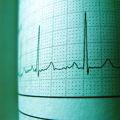 How to Get Your Website Ready for the Google Page Experience and Core Web Vitals Update